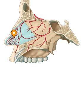 Kiesselbach's plexus - e-Anatomy - IMAIOS