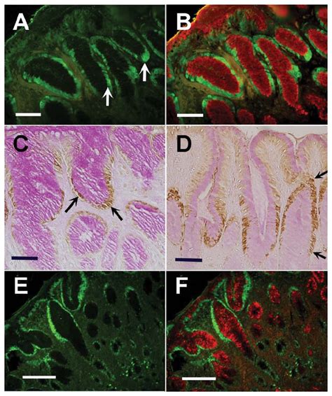 Octamer Binding Transcription Factor Oct Immunohistochemical