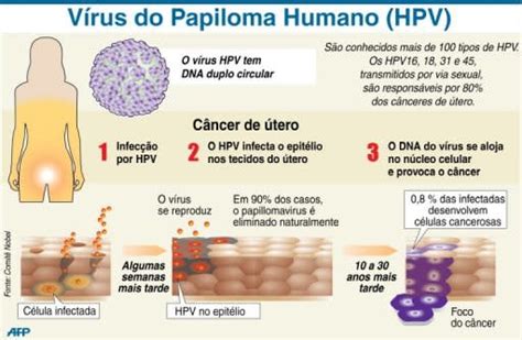 Estudo Vincula Infec O Por Hpv A Doen As Card Acas Em Mulheres