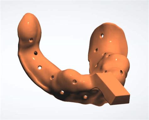 Custom Impression Tray Cad Design Cae Dental