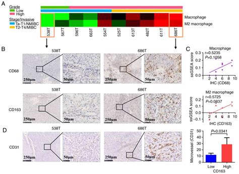 Tumor‑infiltrating M2 Macrophages Driven By Specific Genomic