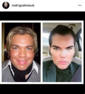 Il Ken Umano Rodrigo Alves Quanto Ha Speso E Come Era Prima Foto