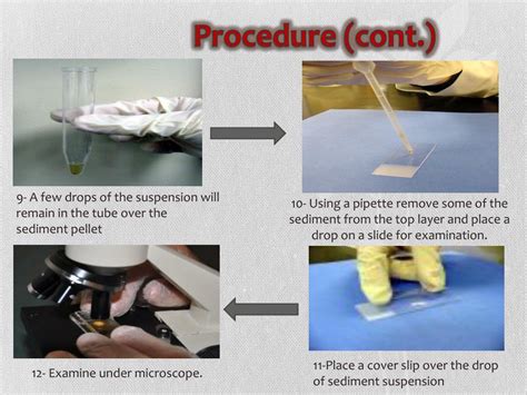 Ppt Concentration Methods Of Fecal Parasites Powerpoint Presentation Id1961542