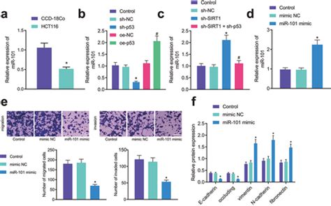 Full Article Sirt Promotes The Progression And Chemoresistance Of