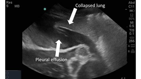 Lung With Pleural Effusion Annotated Feline Sonosite M Turbo C11