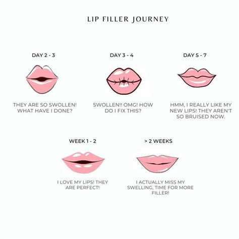 Lip Filler Journey In 2023 Lip Fillers Lips Quotes Cosmetic