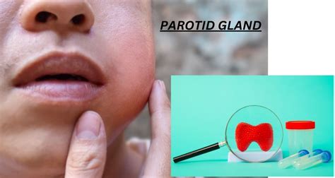 Parotid gland - Free Medical Notes01 FREE FOR ALL