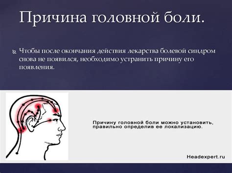 Средства от головной боли - презентация онлайн