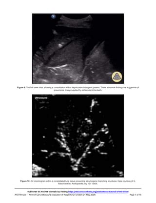 Point Of Care Ultrasound Evaluation Of Respiratory Function Pdf