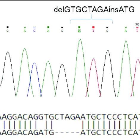 (a) Sanger sequencing view of the patient's homozygous mutation in the ... 