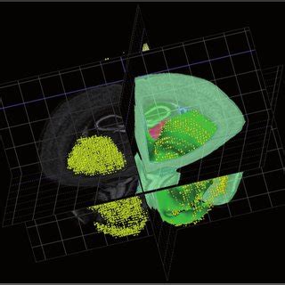 The Adult Mouse Brain Atlas Visualization Of The Striatum And Of The