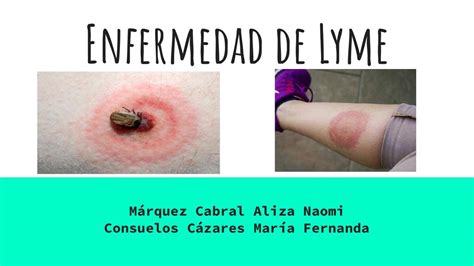 Resúmenes De Enfermedad De Lyme Descarga Apuntes De Enfermedad De Lyme