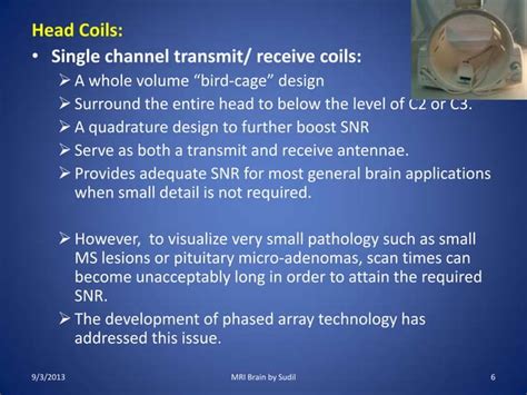 MRI Procedure of Brain | PPT