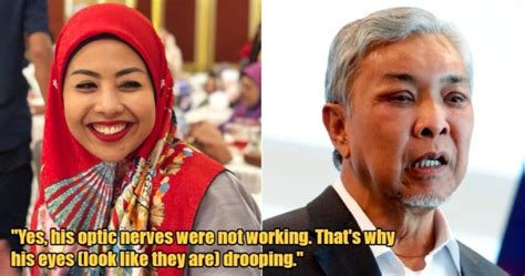 Zahid Hamidi S Daughter Reveals He Had Eye Surgery Due To Optic Nerve