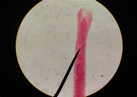 Close Up Egg with Adult of Parasite. Stock Image - Image of meat ...