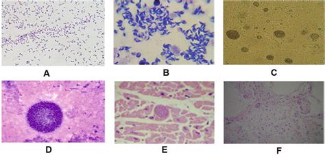 Toxoplasmosis Brain Histology