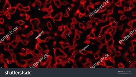 Blood Cells Under Microscope Blood Clots Stock Photo 613900685 | Shutterstock