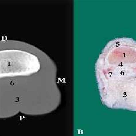 Pdf Radiographic And Computed Tomographic Anatomy Of The Fetlock