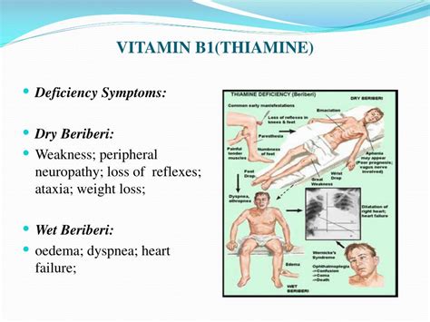 Ppt Micronutrient Deficiency Disorders Powerpoint Presentation Free