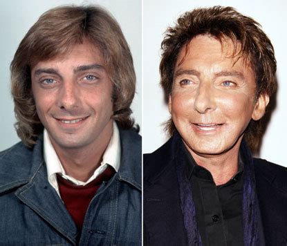 28 Celebrity Plastic Surgery Nightmares Barry Manilow Before And