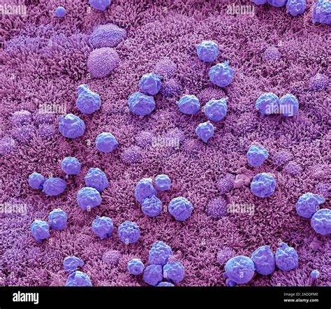 Nasal Epithelium Coloured Scanning Electron Micrograph SEM Shown