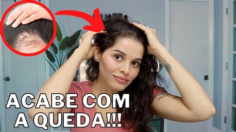 Como Fazer O Cabelo Parar De Cair - 5 Dicas para Fazer o Cabelo PARAR DE CAIR - QUEDA CAPILAR O QUE FAZER ...