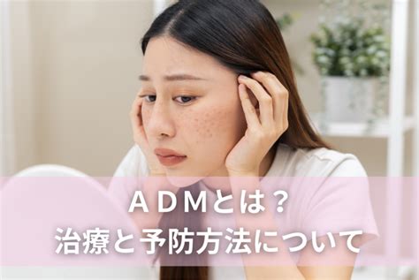 Adm（後天性真皮メラノサイトーシス）とは？治療と予防方法 赤ちゃん・子供のあざ治療なら｜最新レーザー治療×形成外科専門医の大阪梅田形成クリニック