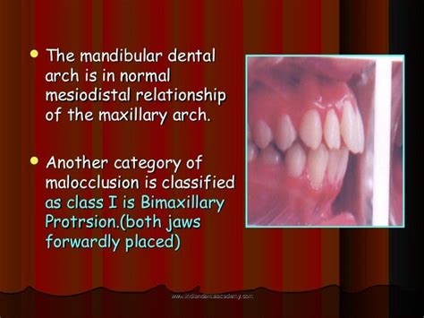 Malocclusion Certified Fixed Orthodontic Courses By Indian Dental