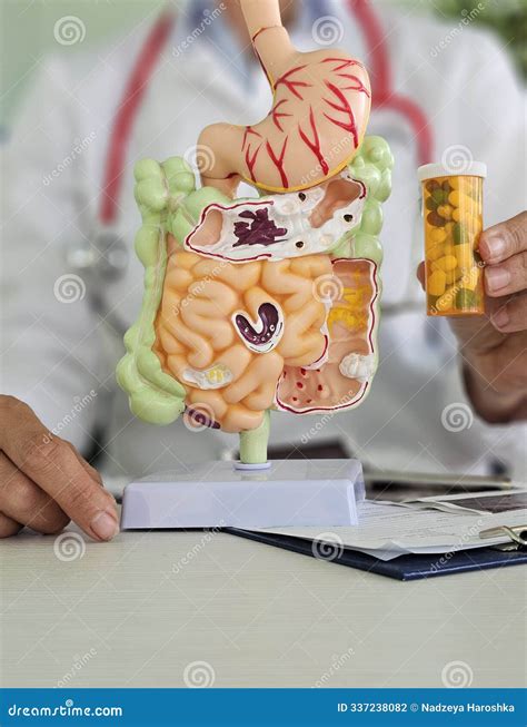 Intestinal Tract and Tablets in the Hands of Doctor with Model of