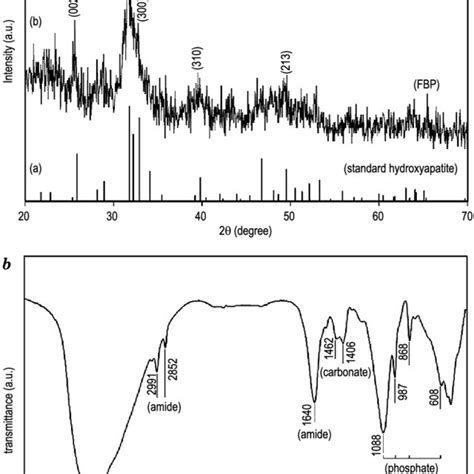 Xrd Patterns Of Standard Hydroxyapatite And Fbp A And Ft Ir Spectrum