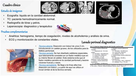 Hernias Eventraci N Evisceraci N Y Traumatismo Abdominal Pptx