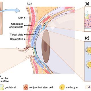 Illustration of the surgical strategies of eyelid reconstruction. FTSG ...