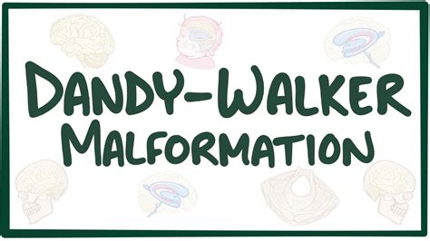 Dandy-Walker malformation: Video, Causes, & Meaning | Osmosis