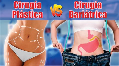 Total Imagem Abdominoplastia Flor De Lis Antes Y Despu S Br