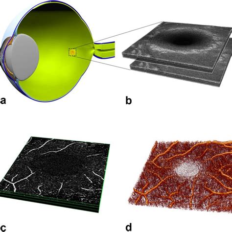 Presentation Of Image Processing In Three Dimensional Optical Coherence