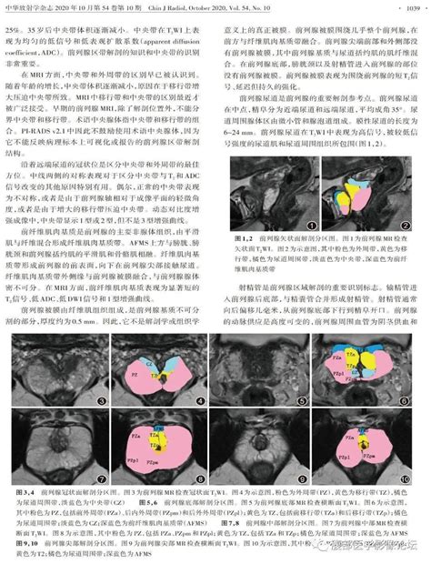 影像解剖丨前列腺mri解剖分区医学