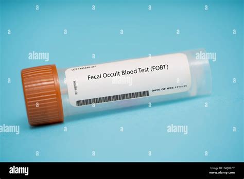 Faecal Occult Blood Test Hi Res Stock Photography And Images Alamy