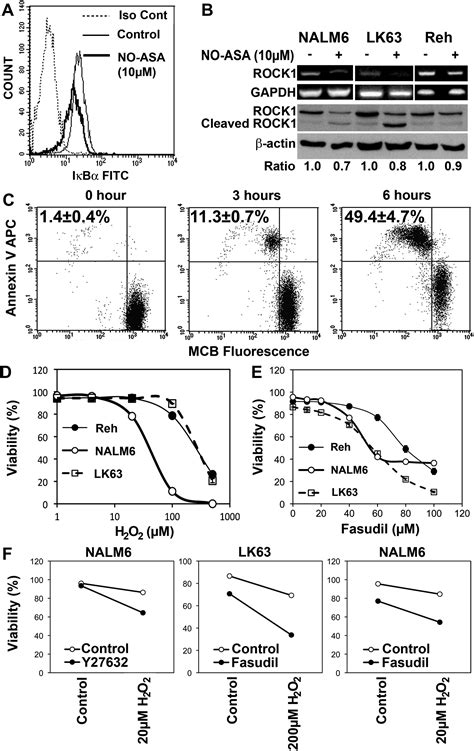 Para NO aspirin inhibits NF κB and induces apoptosis in B cell