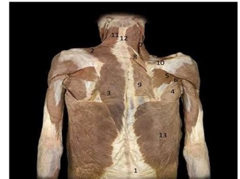 Superficial Back Muscles Cadaver Flashcards Quizlet