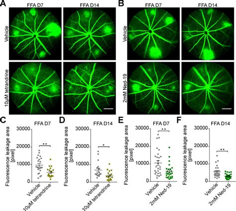 Tpc Promotes Choroidal Angiogenesis And Inflammation In A Mouse Model