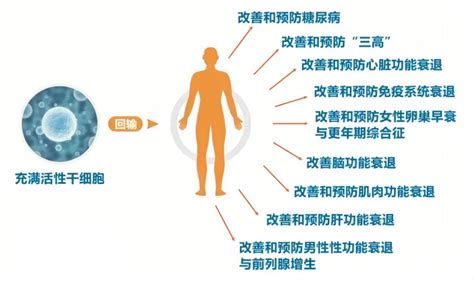 干细胞回输 您想知道的知识都在这里！ 知乎