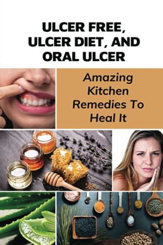 Ulcer Free Ulcer Diet And Oral Ulcer Amazing Kitchen Remedies To Heal It How Do You Get Rid