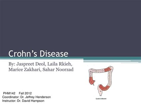 Ppt Crohn’s Disease Powerpoint Presentation Free Download Id 3709247