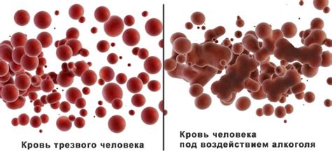 Флебавен: инструкция по применению, цена, отзывы, аналоги и состав