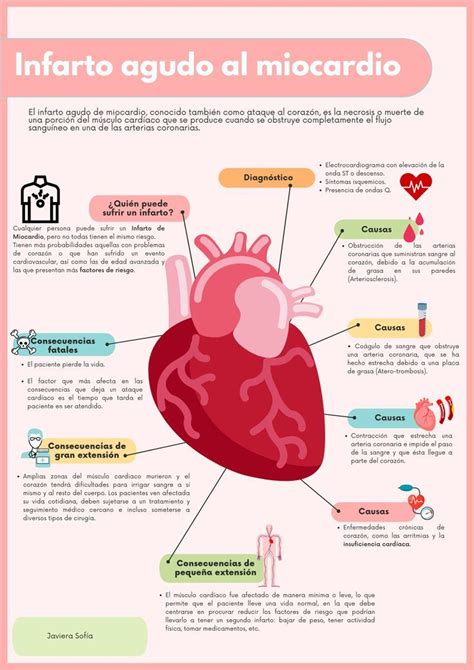 Infarto Agudo Al Miocardio Causas Y Consecuencias Cosas De Enfermeria Practicas De