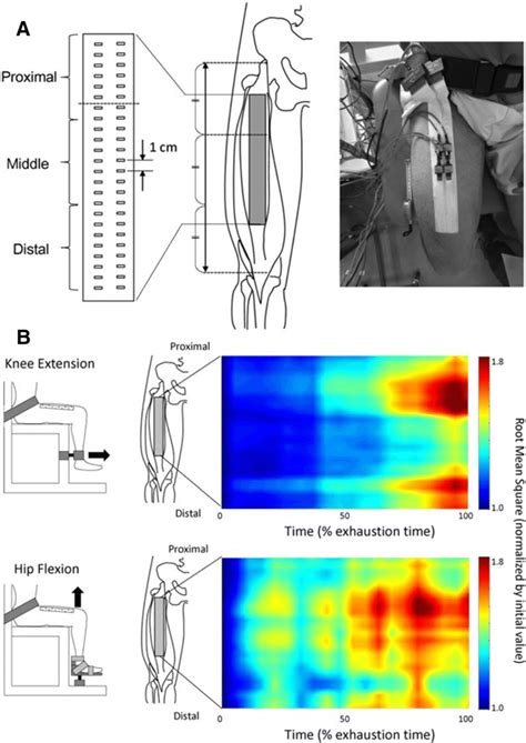 High Density Surface EMG A Multi Channel Surface Electromyography