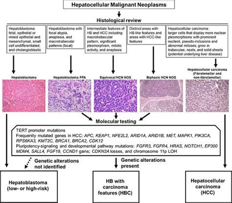 A New High Risk Subtype Of Pediatric Liver Cancer Identified