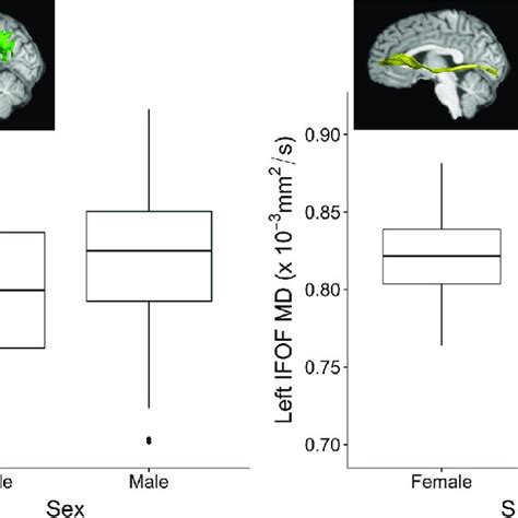 Sex Differences On White Matter Microstructure Of Examined Tracts After