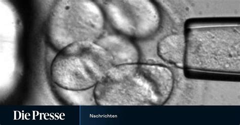 Ohne Sex leben Strudelwürmer ewig dank Stammzellen DiePresse