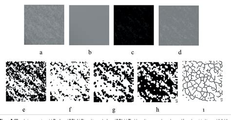 Figure From The Investigation Of Radiographic Findings Of Mandibles